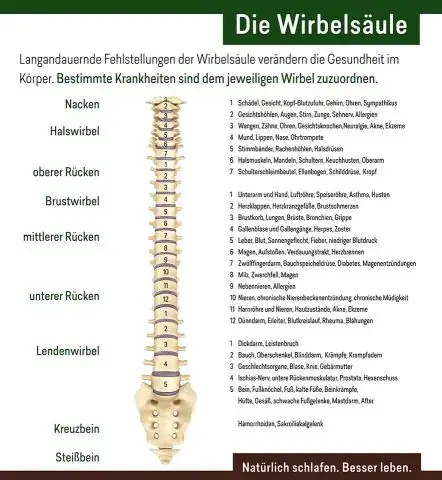 Infografik zur Wirbelsäule und den Folgen dauerhafter Fehlstellungen